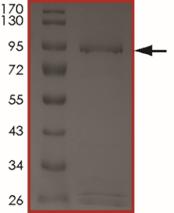 EGFR (d747-752 P753S), Active
